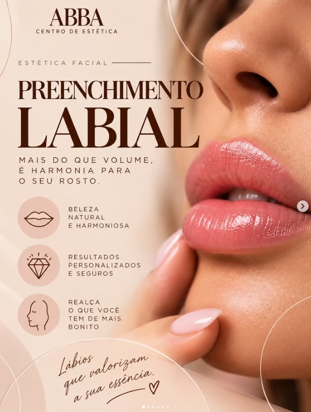 Post ABBA: Preenchimento labial, mais do que volume é harmonia