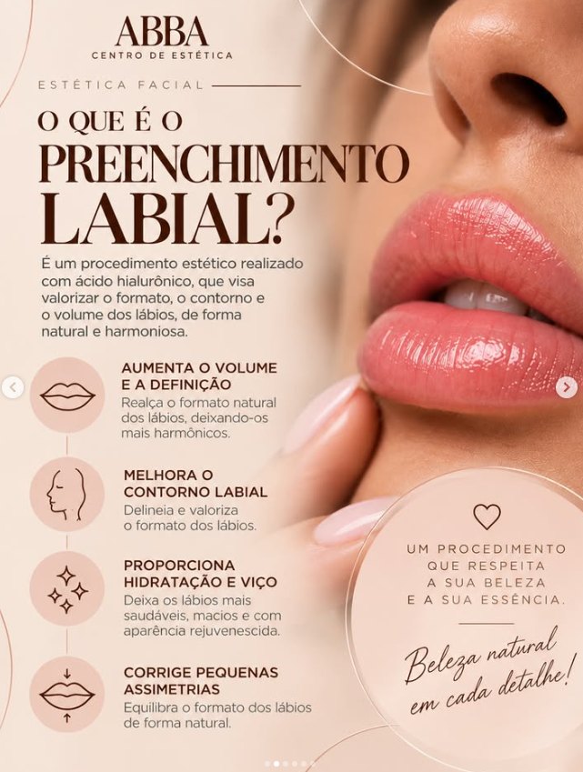 Post ABBA: O que é o preenchimento labial e seus benefícios